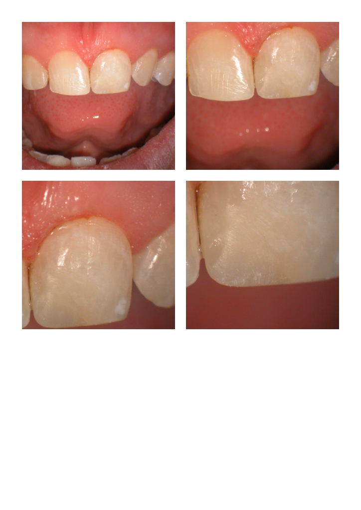 DB anterior case pg 5.jpg